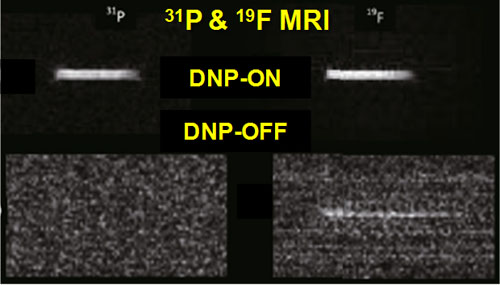 31P和19F在加DNP（上排）和不加DNP（下排）同时采集获得的图像